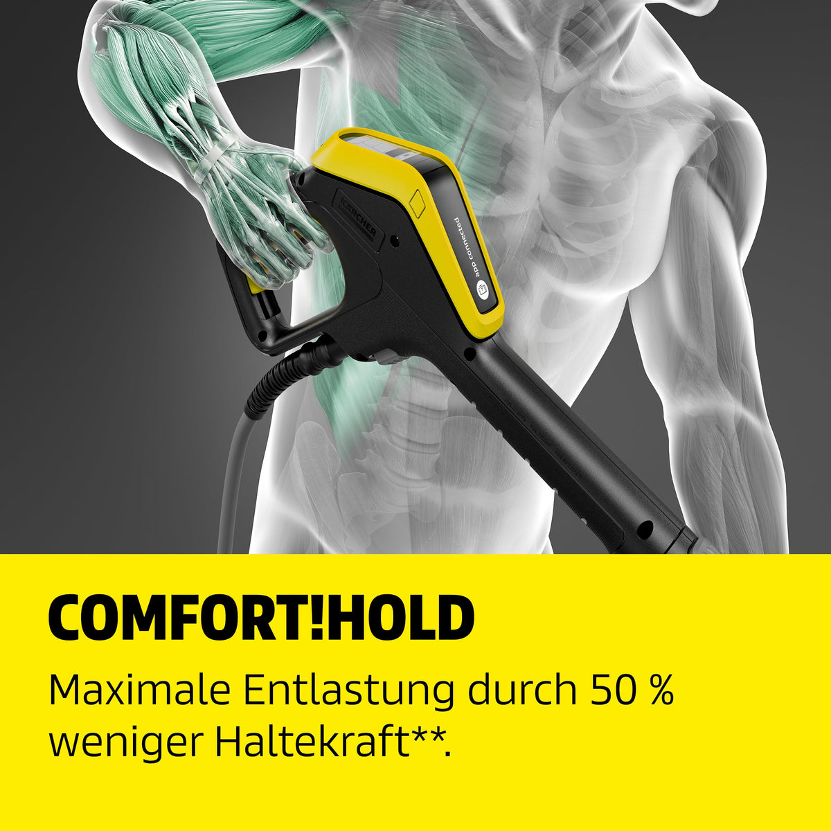 Elektrischer Hochdruckreiniger 180 bar, 600 l/h mit App-Steuerung, Car-and-Home-Kit und 10 m Schlauch, Gelb